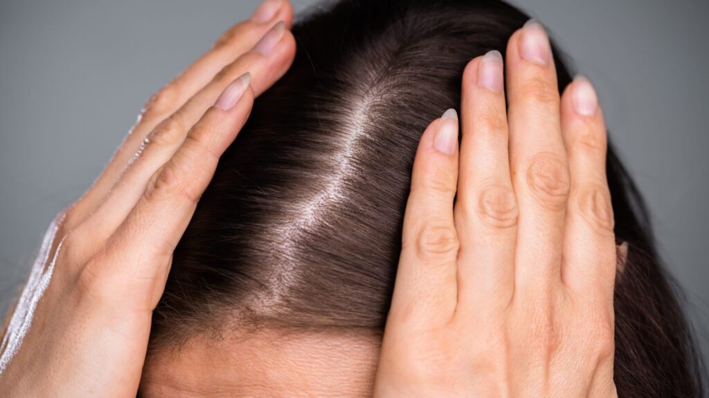 A queda de cabelo pode ser um problema. Mas se você souber qual penteado fazer em sua cabeça, poderá disfarçar as falhas com muita facilidade.