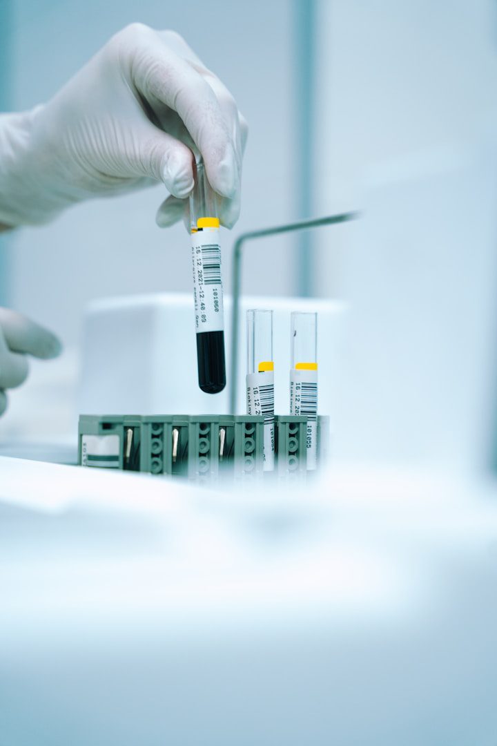 Na sepse, os antibióticos devem ser administrados imediatamente e a condição do paciente deve ser monitorada. E, graças aos exames de sangue, isso é possível em alguns casos.